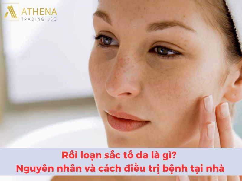 Rối loạn sắc tố da là gì - Nguyên nhân và cách điều trị bệnh tại nhà