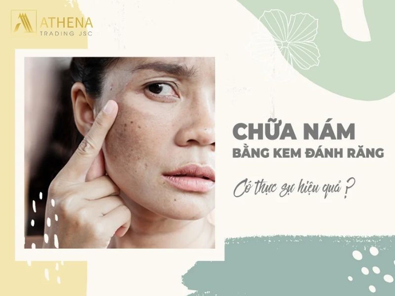 Trị nám bằng kem đánh răng có thực sự hiệu quả