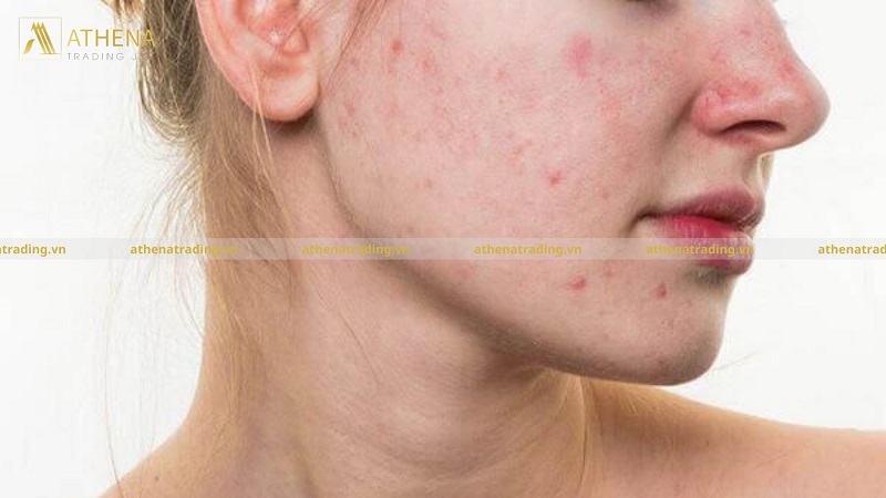 Top 1 mask phục hồi da "cứu nguy" cấp tốc hiện nay