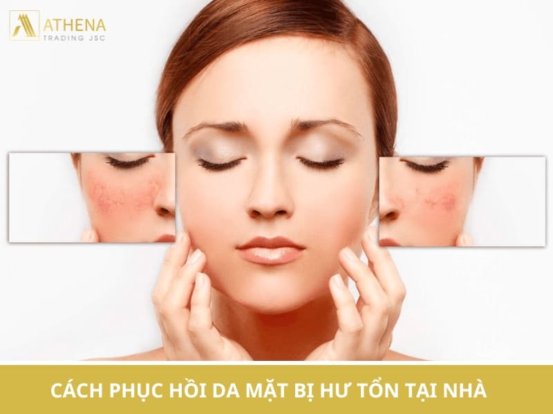 cách phục hồi da mặt bị hư tổn tại nhà