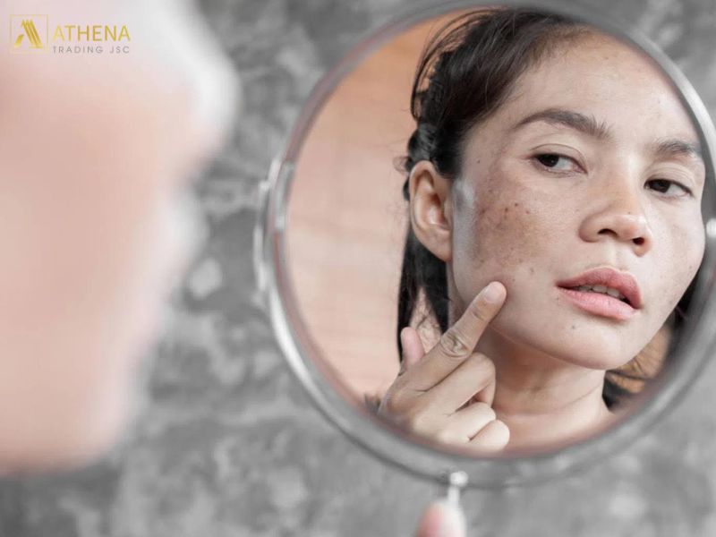 Lão hóa sẽ khiến da mất đi khả năng sản sinh collagen và elastin, dẫn đến tình trạng da sạm đen, chảy xệ và xuất hiện nhiều nếp nhăn