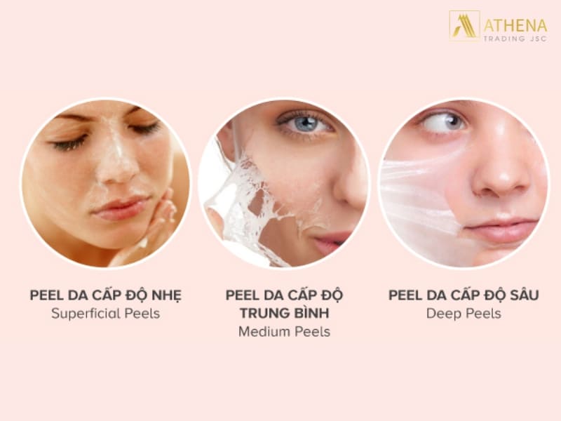 3 cấp độ peel da