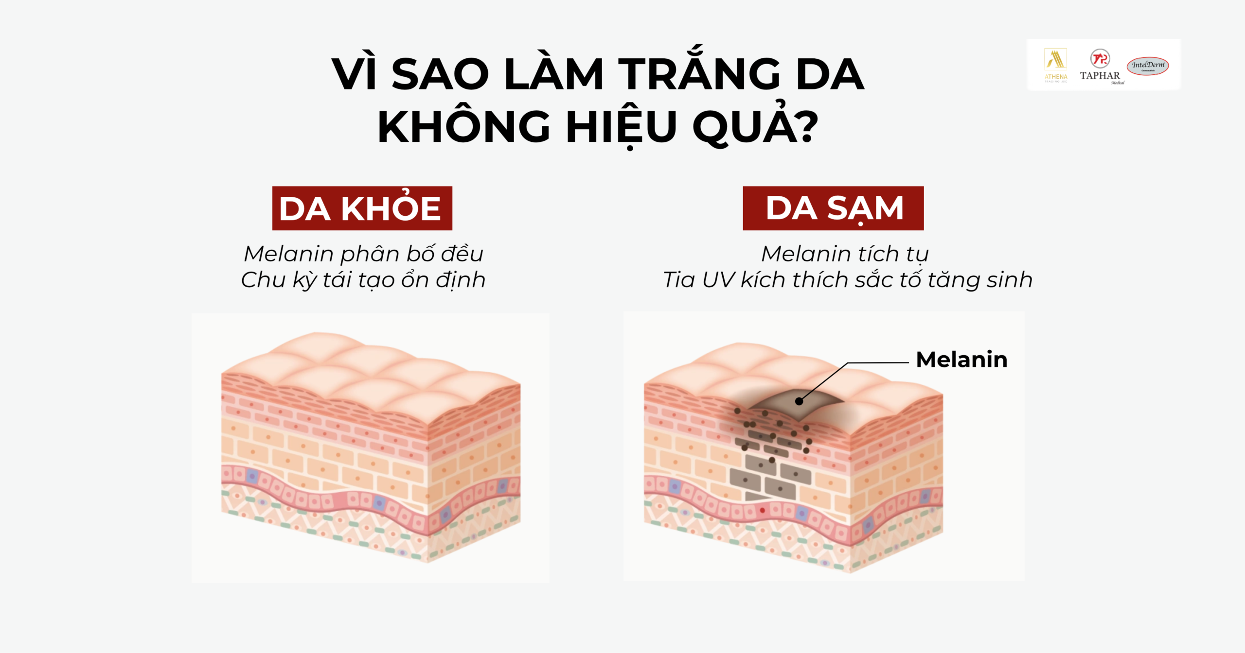 Tại sao làm trắng da không hiệu quả do tác động melanin