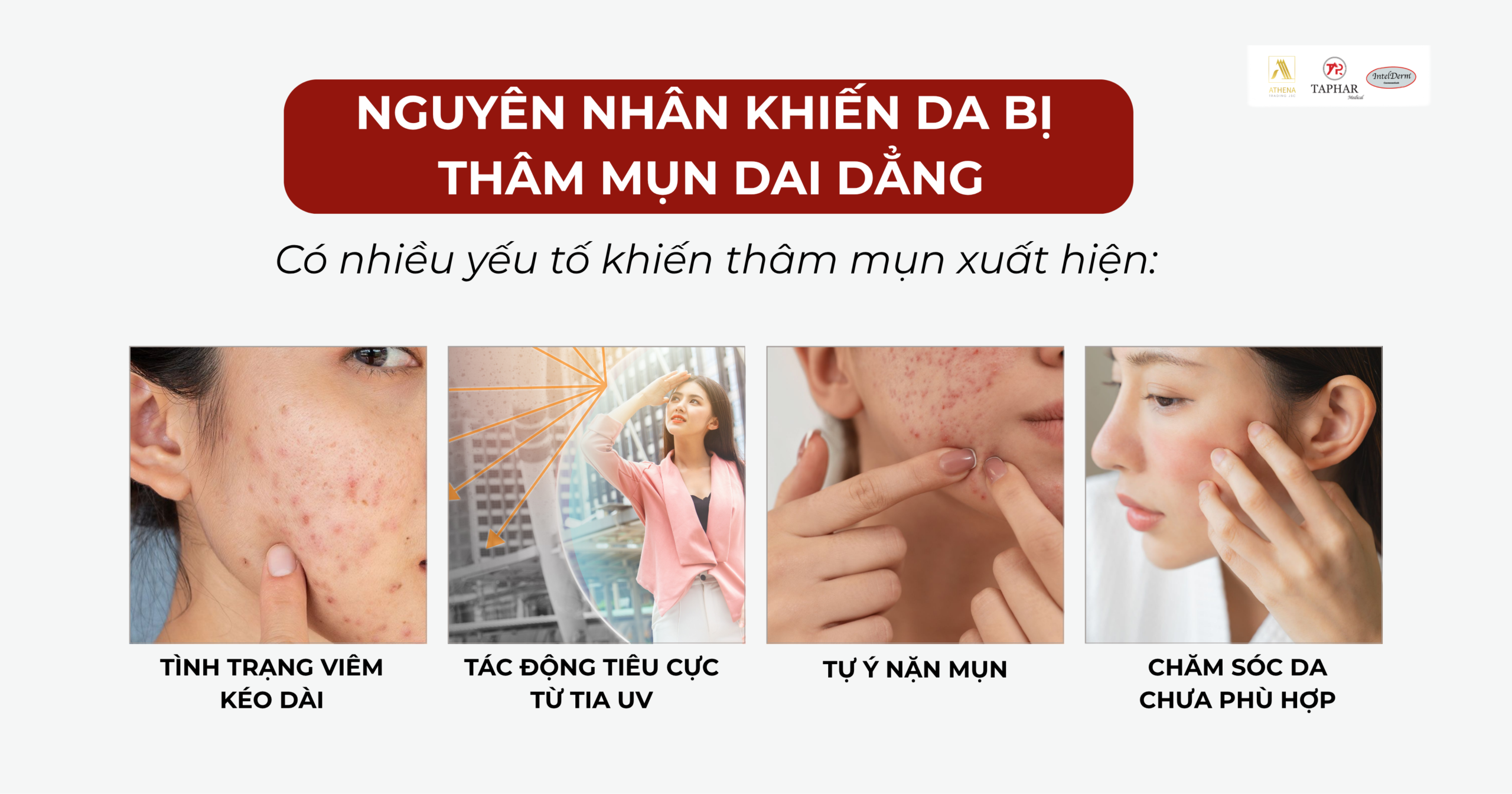 Các nguyên nhân chính khiến da bị thâm mụn và cách trị thâm mụn hiệu quả giúp mờ thâm nhanh