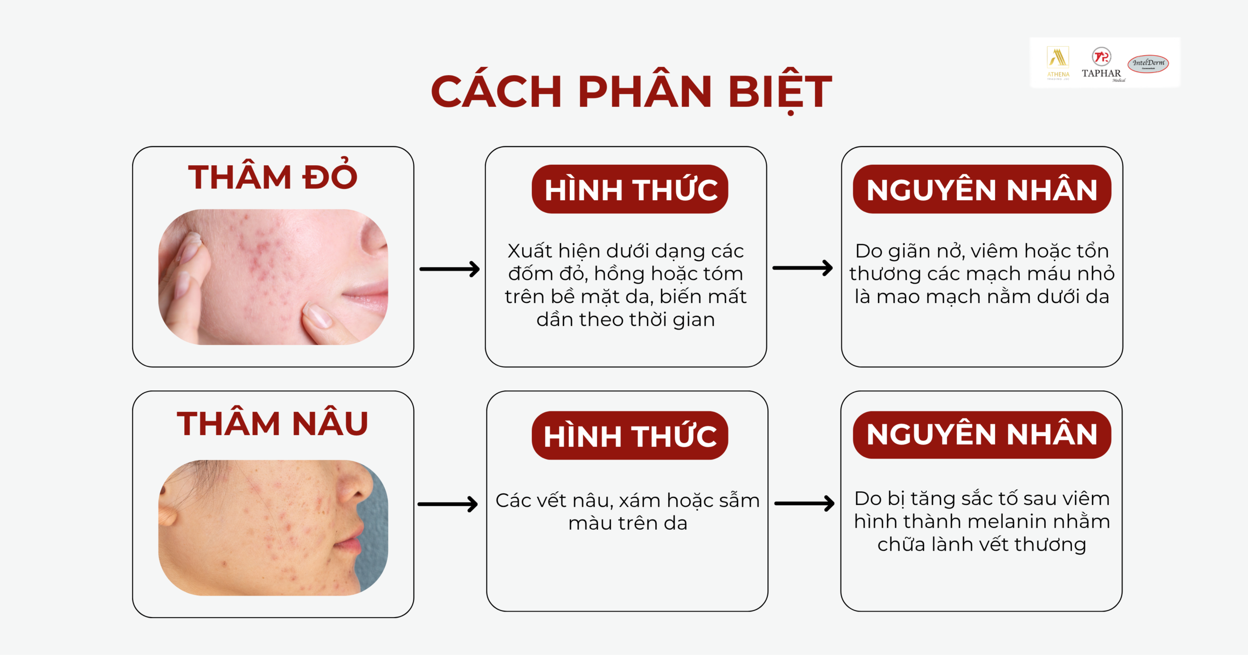 trị thâm mụn hiệu quả