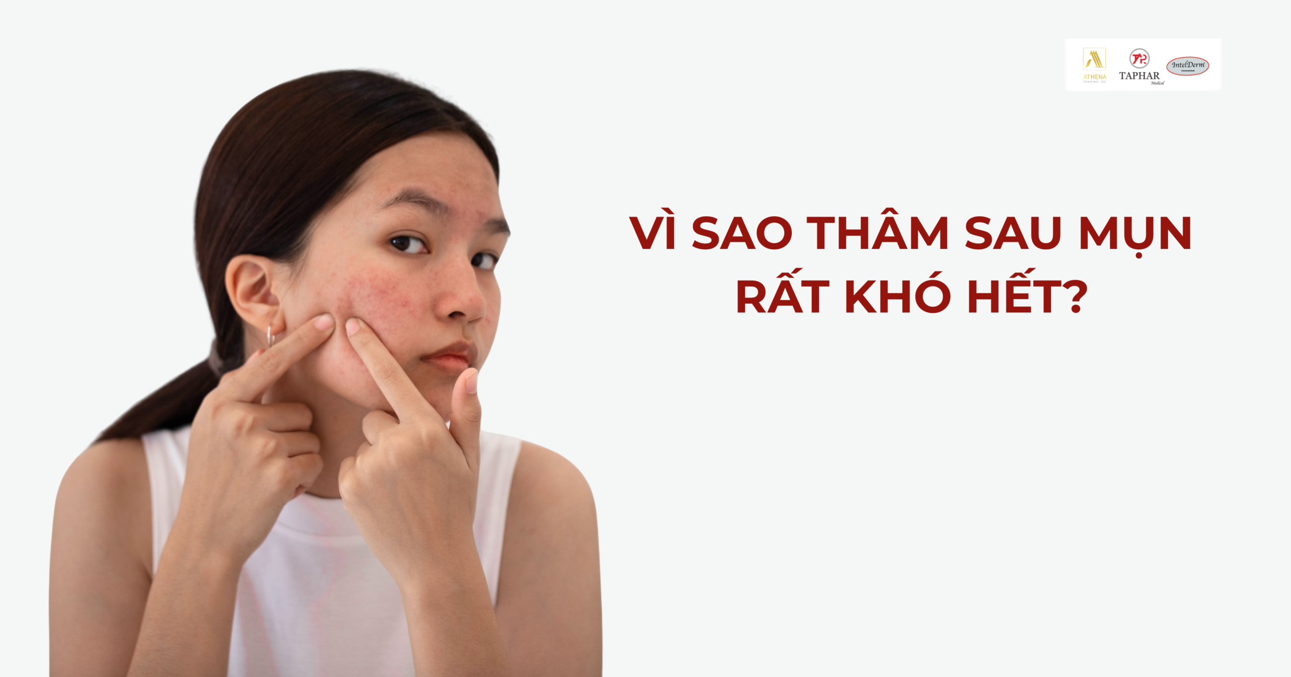 Trị thâm sau mụn