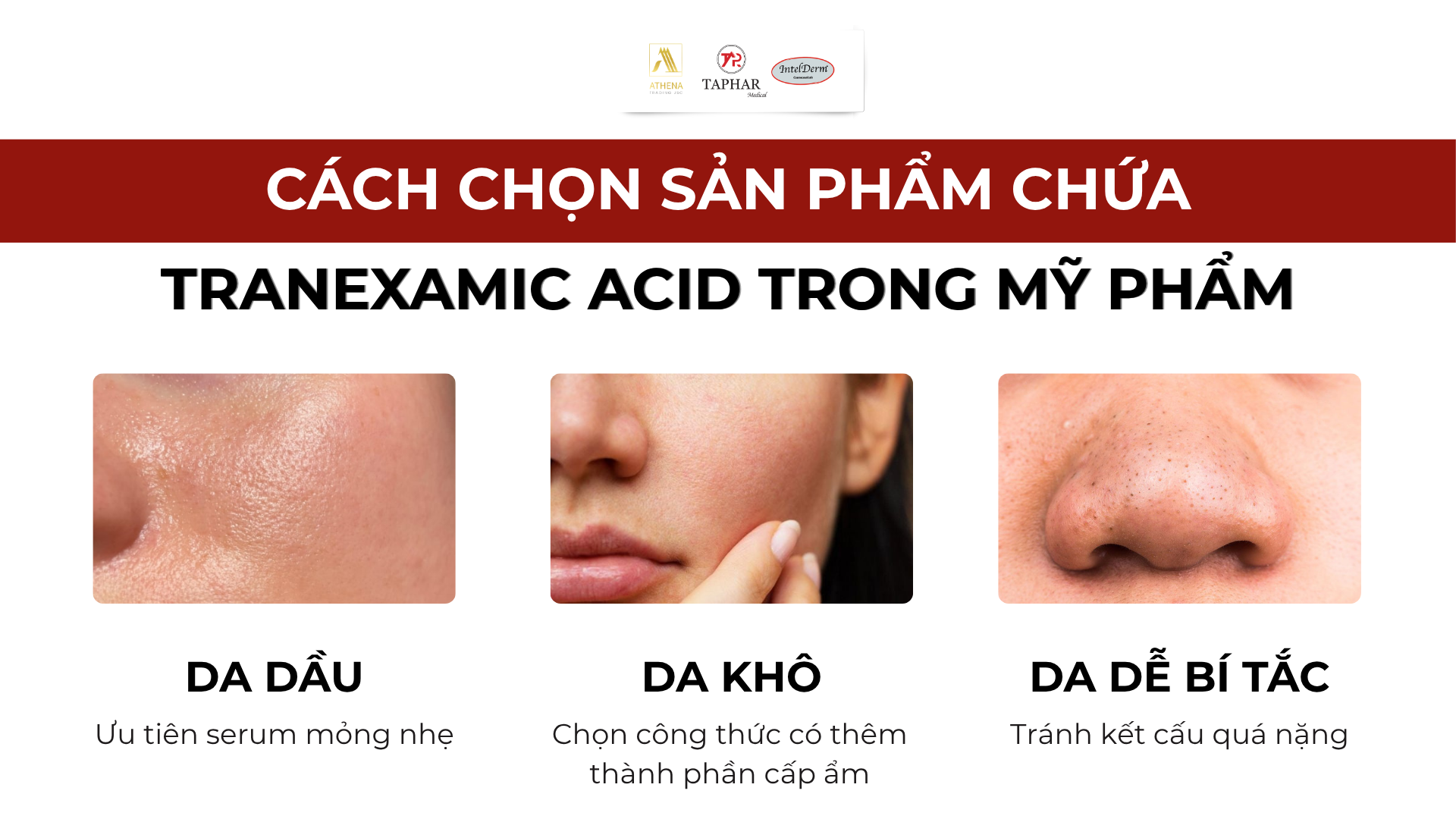 Cách chọn sản phẩm chứa Tranexamic Acid trong mỹ phẩm