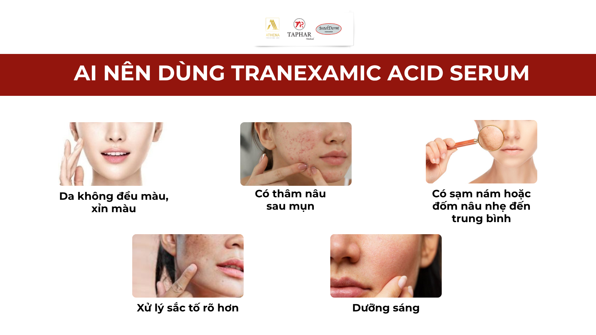 Ai nên dùng Tranexamic Acid serum
