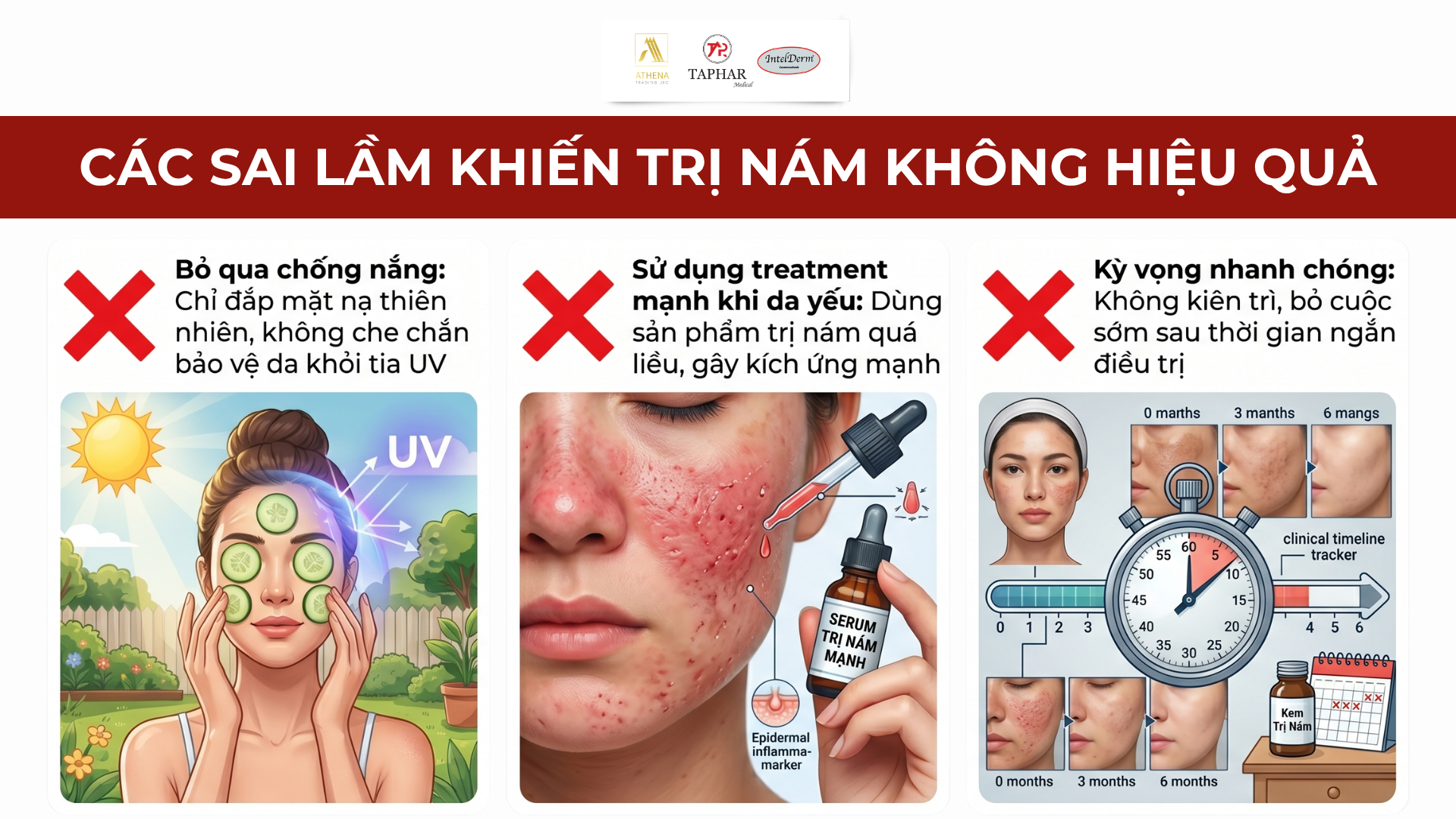 Các Sai Lầm Khiến Trị Nám Không Hiệu Quả