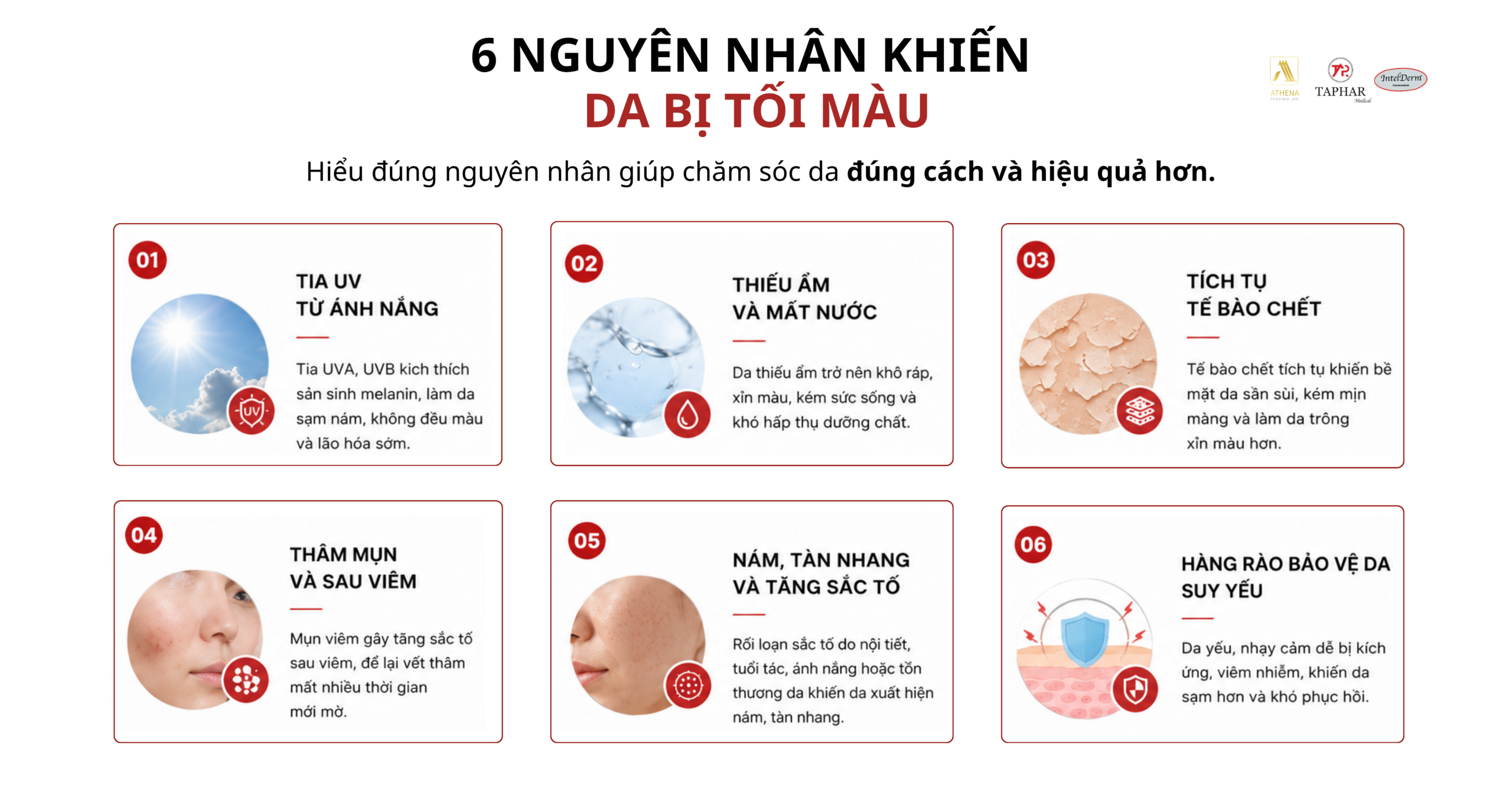 tia UV, thiếu ẩm và thâm mụn khiến da kém đều màu 