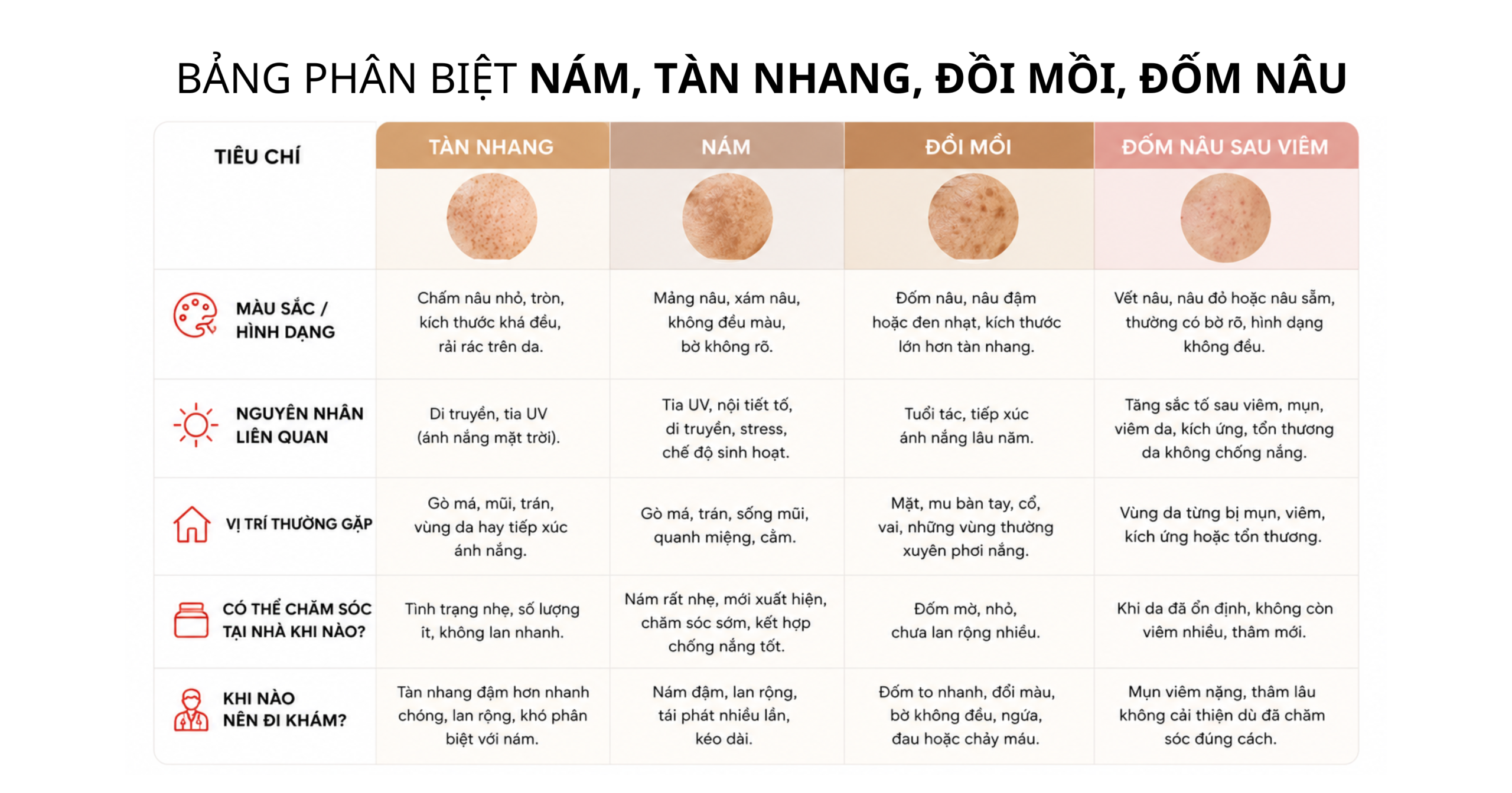 bảng phân biệt nám tàn nhang đồi mồi và đốm nâu