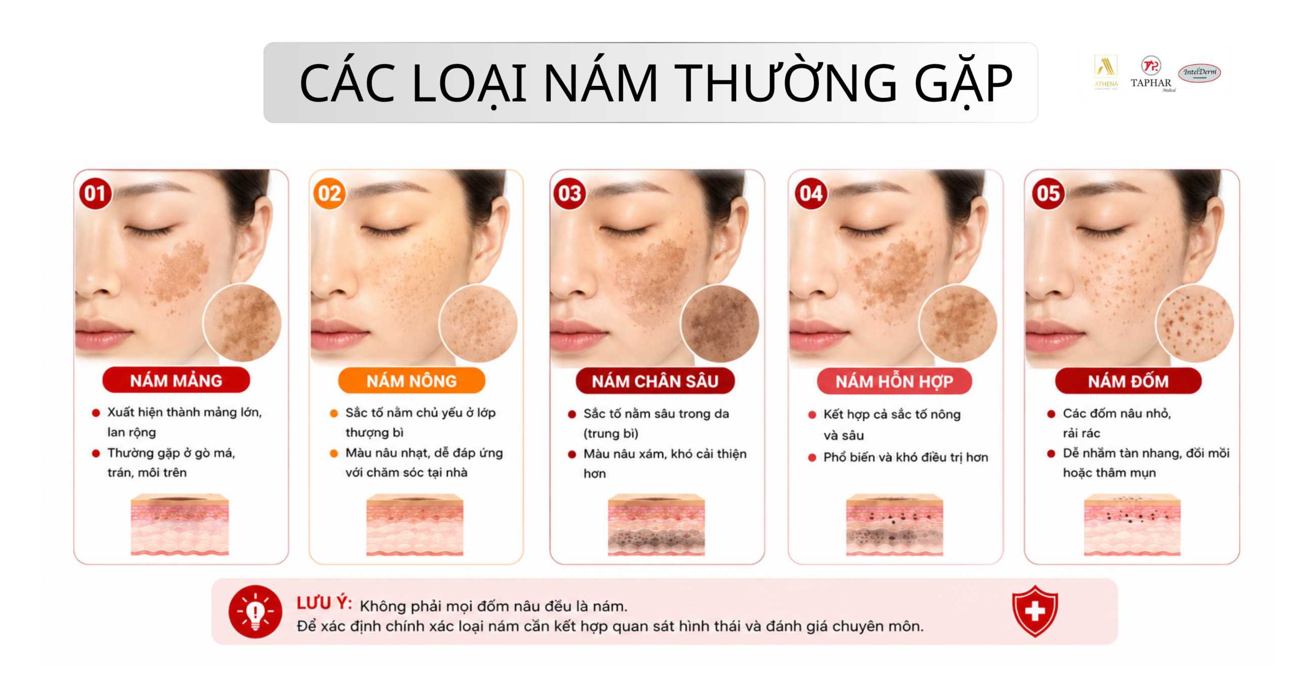 các loại nám da thường gặp gồm nám mảng nám chân sâu nám hỗn hợp nám đốm