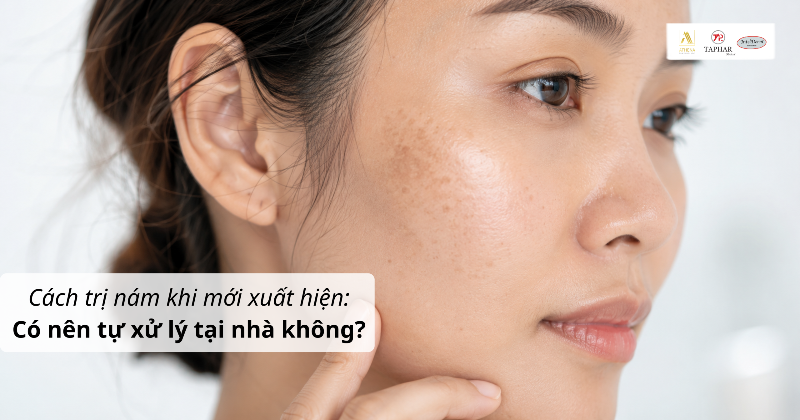 cách trị nám khi mới xuất hiện