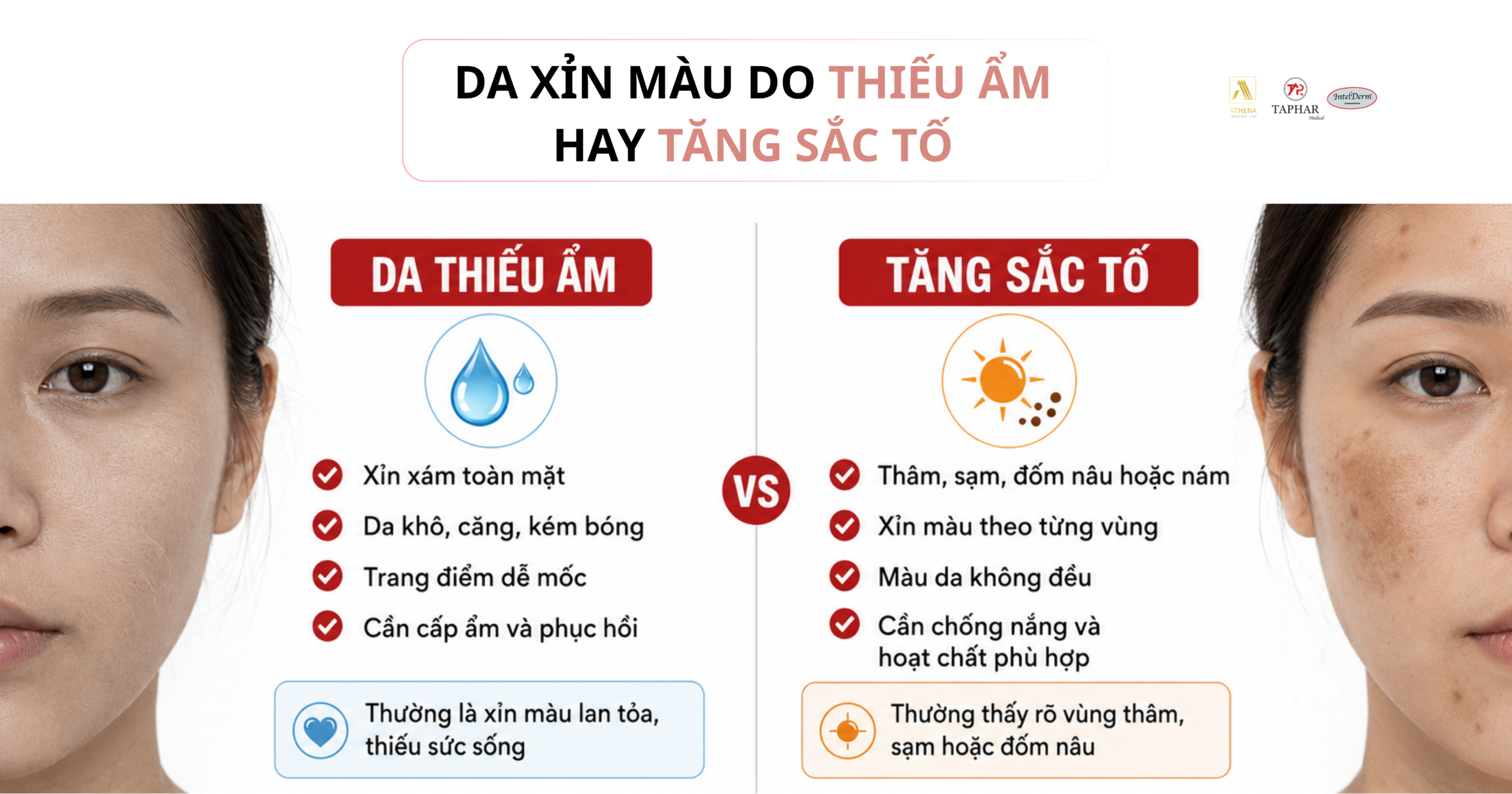 da xỉn màu do thiếu ẩm hay tăng sắc tố