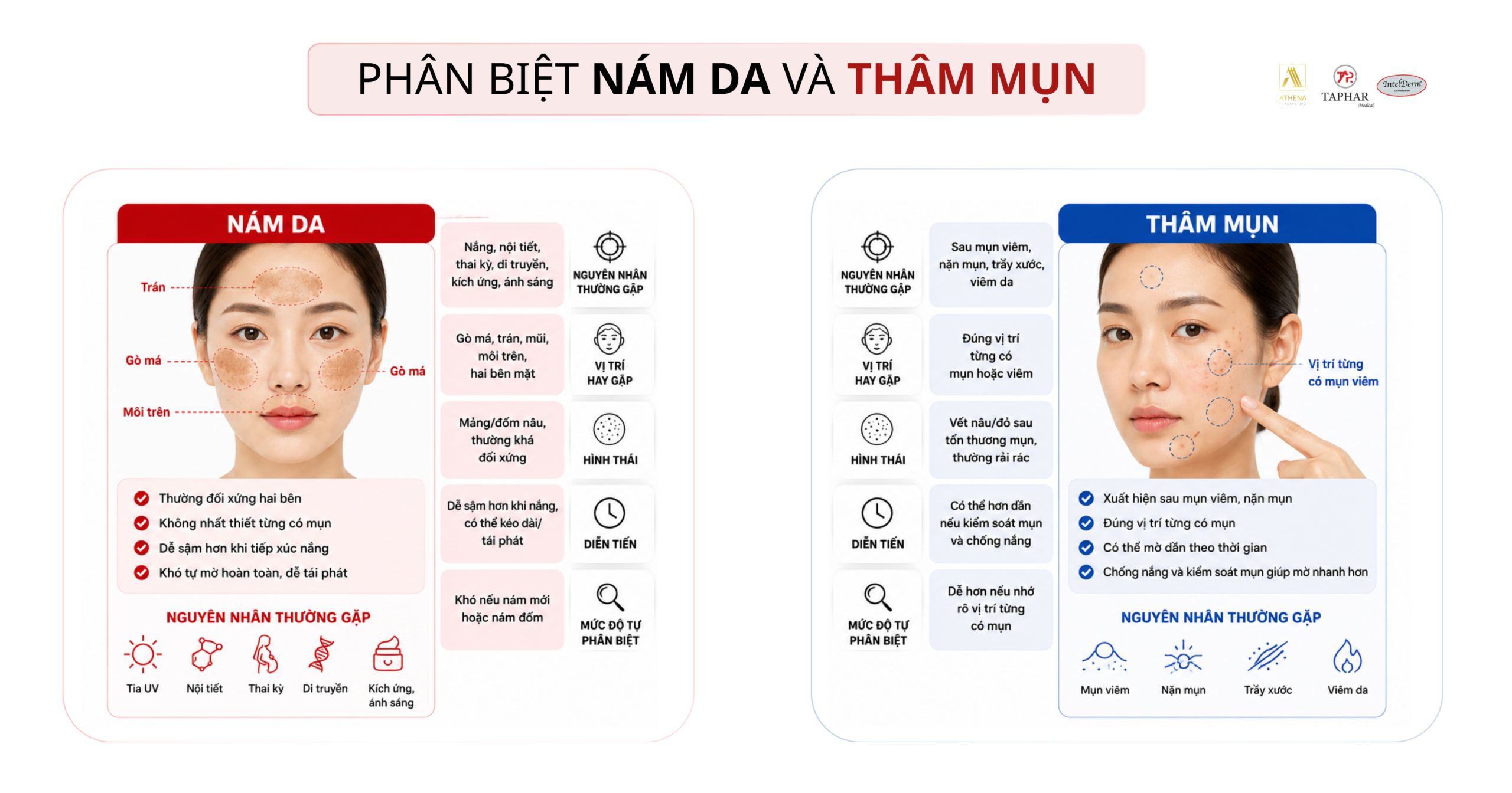 phân biệt nám và thâm mụn tại nhà qua vị trí và hình thái