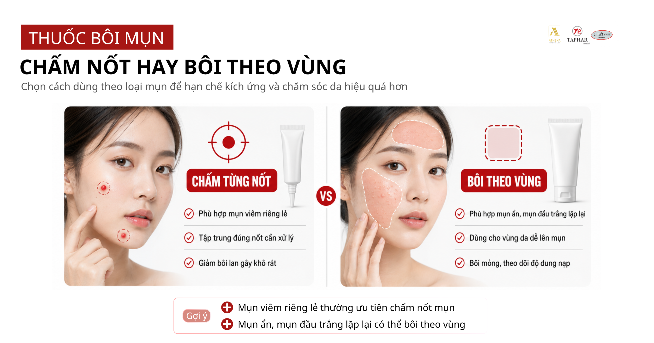 thuốc bôi mụn nên chấm từng nốt hay bôi theo vùng da mụn