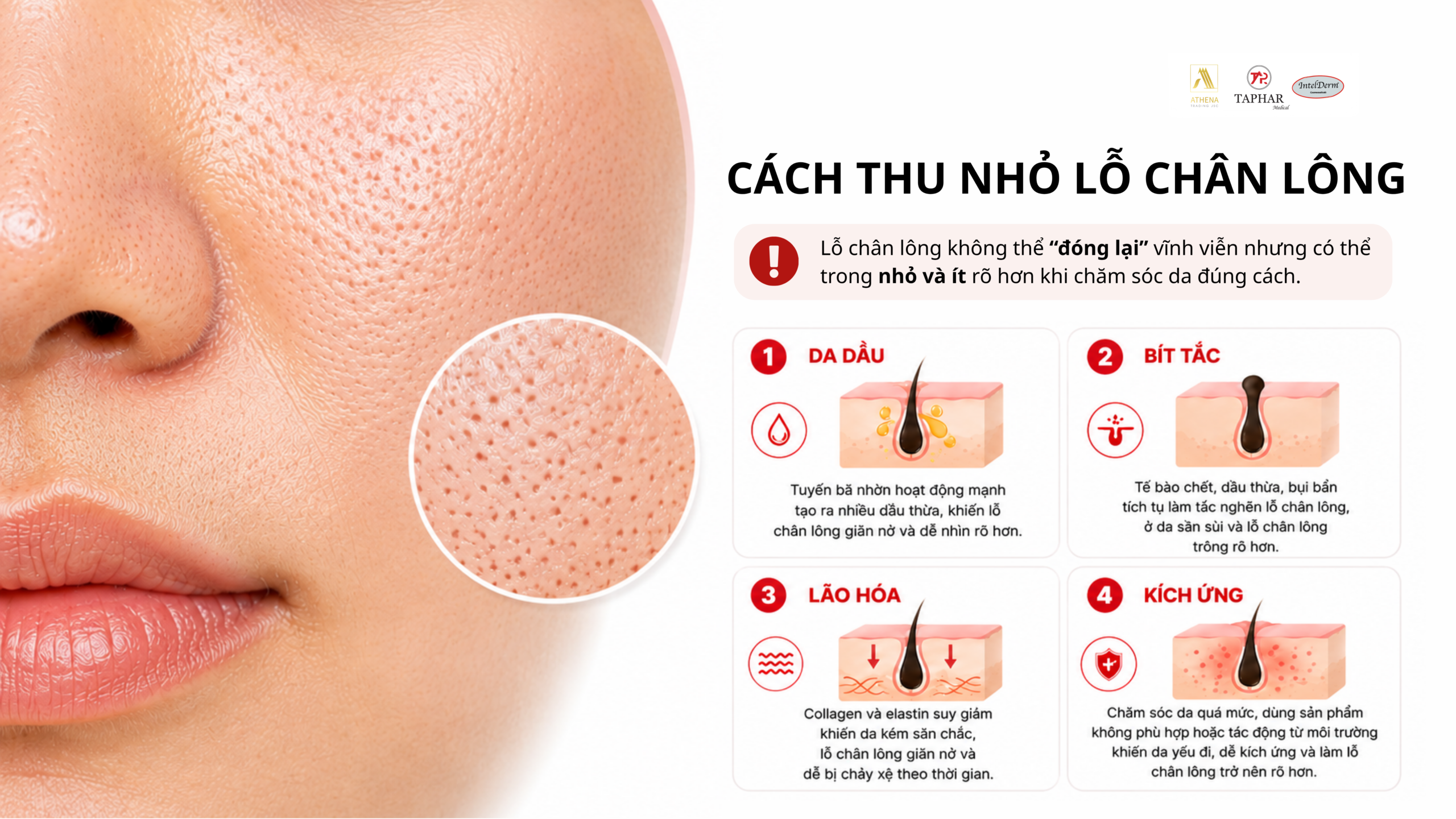  cách thu nhỏ lỗ chân lông theo từng nguyên nhân