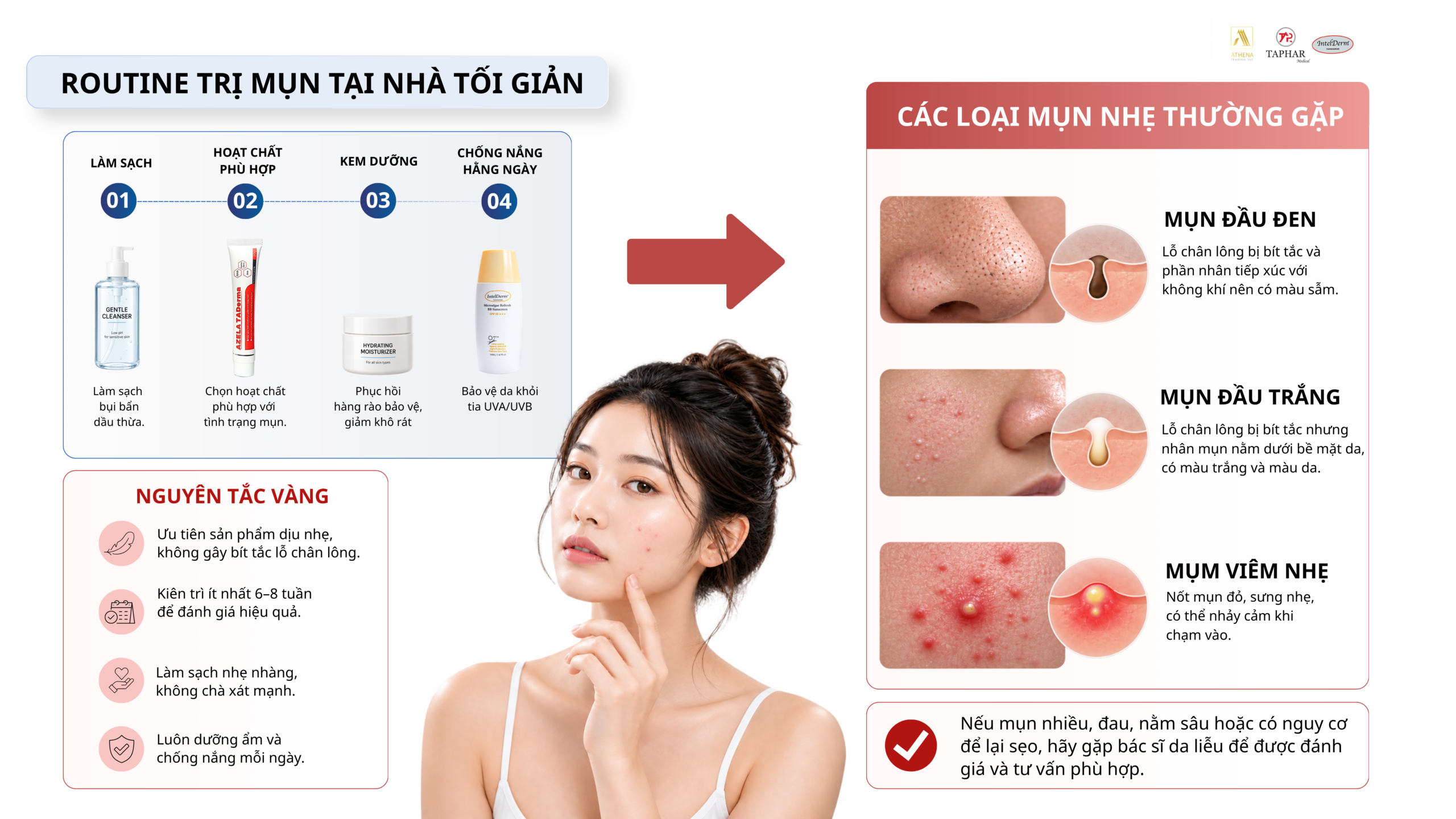 cách trị mụn tại nhà an toàn cho người mới bắt đầu