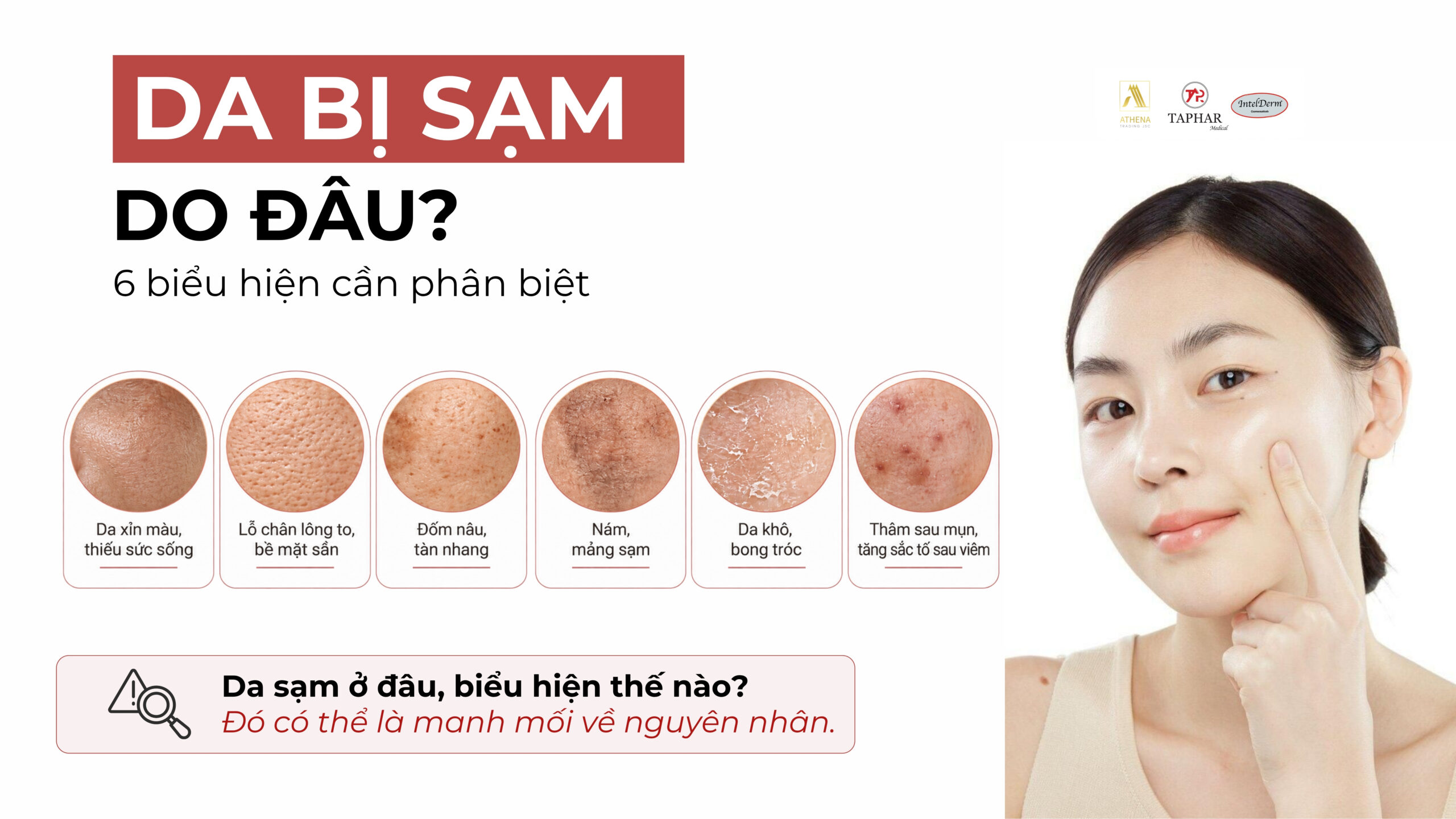 Da bị sạm do đâu và 6 biểu hiện cần phân biệt