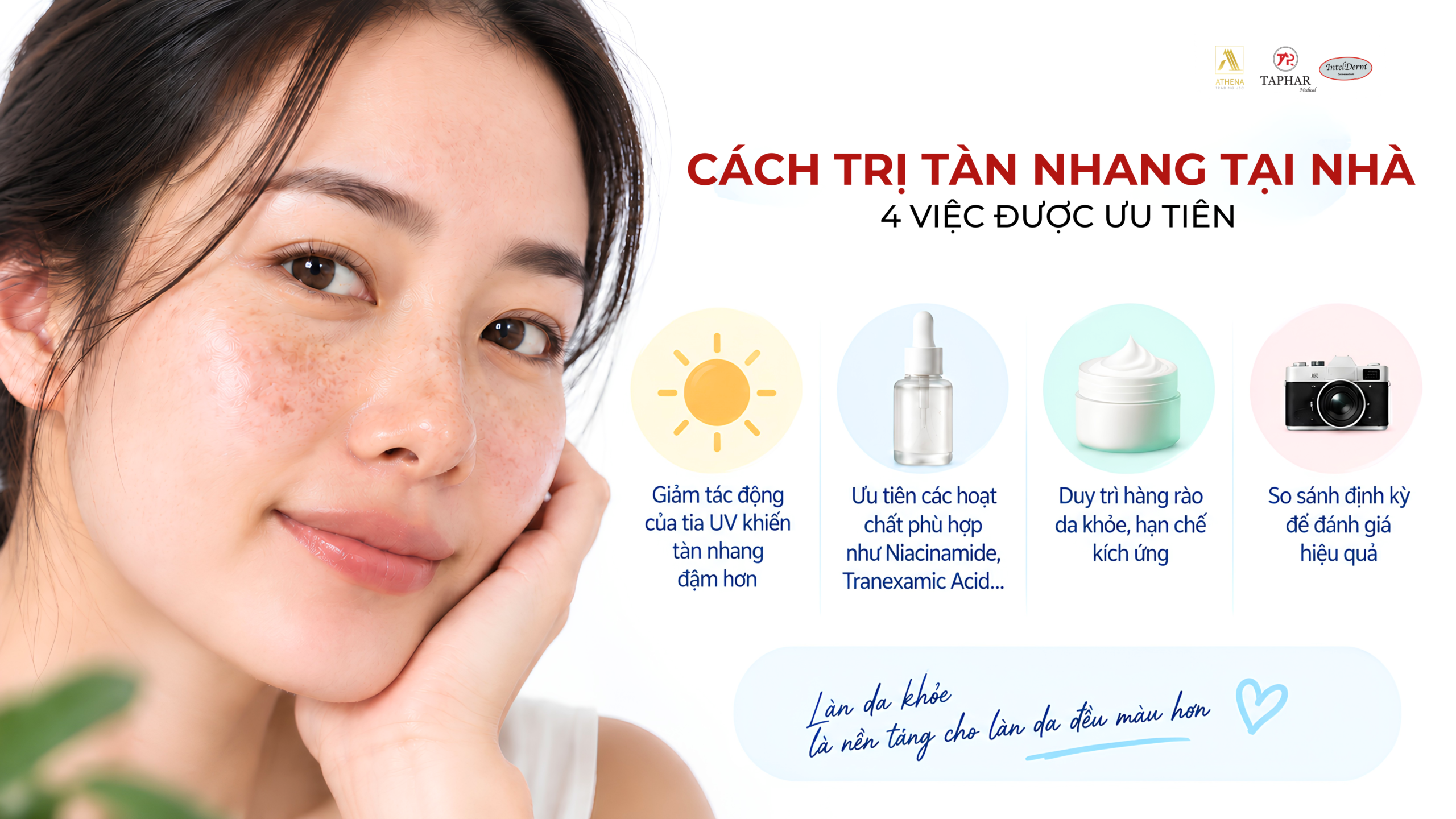 Cách trị tàn nhang tại nhà với 4 việc nên ưu tiên