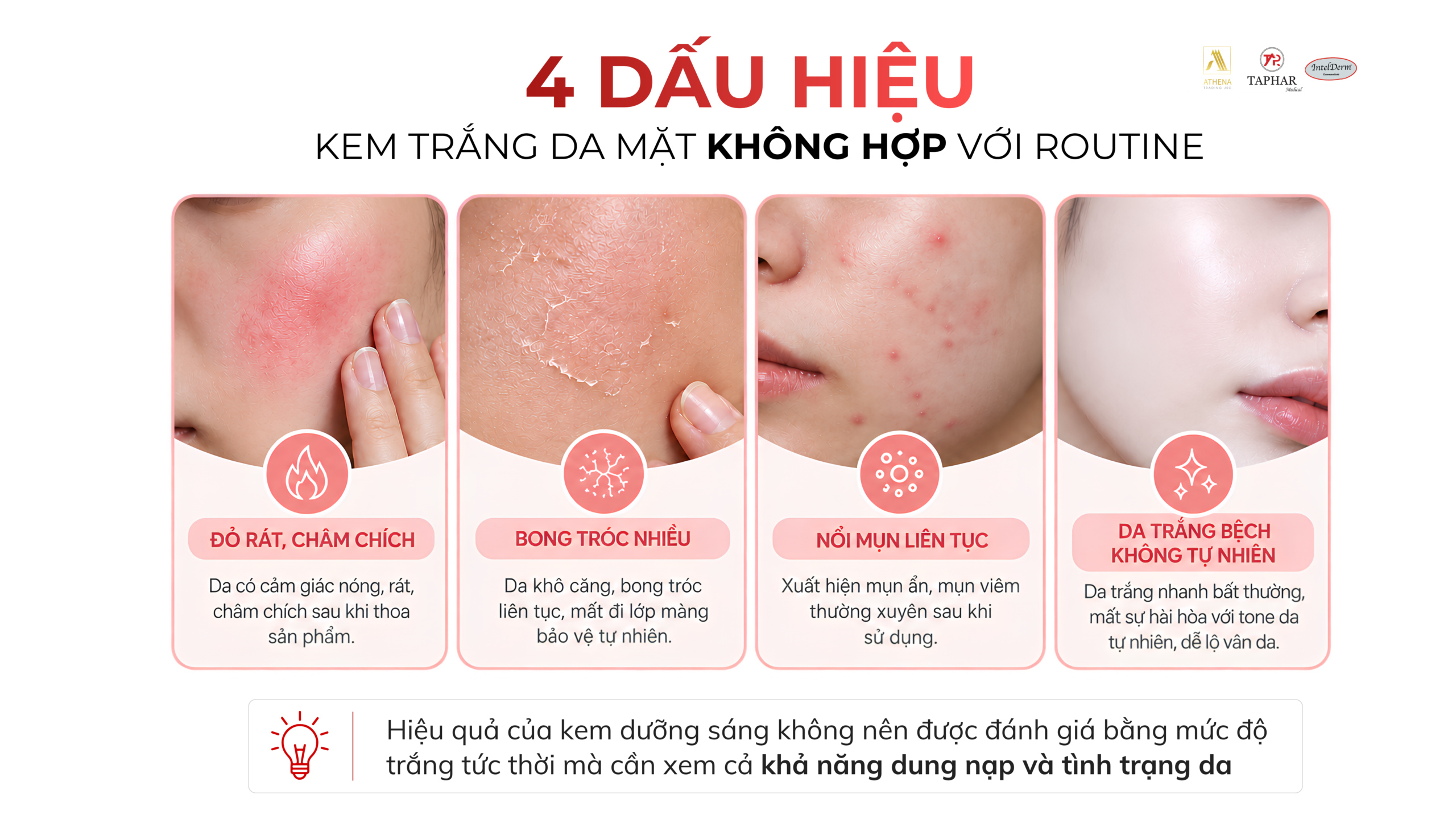 4 dấu hiệu kem trắng da mặt không phù hợp với routine
