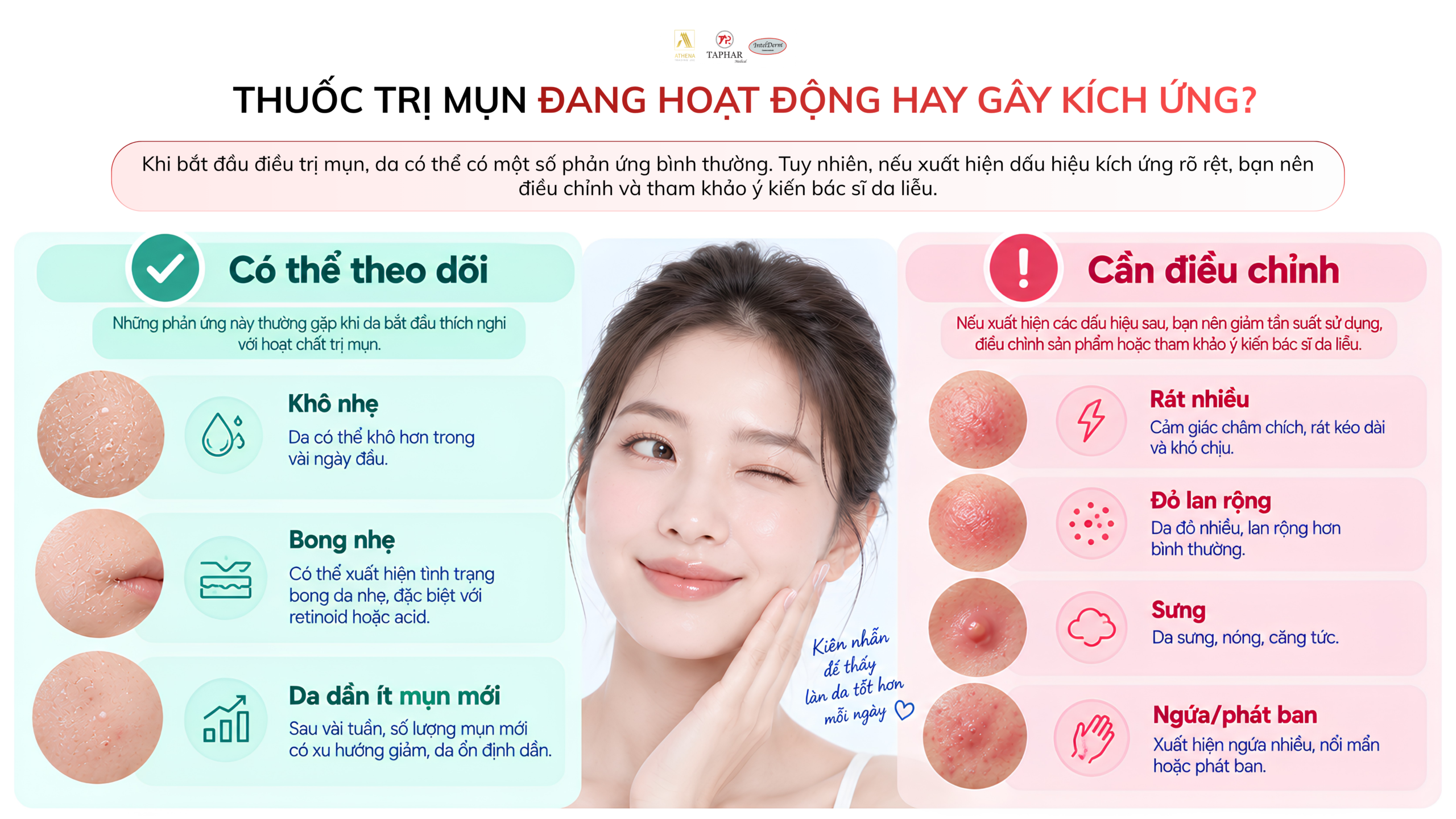 Những sai lầm khi sử dụng thuốc trị mụn