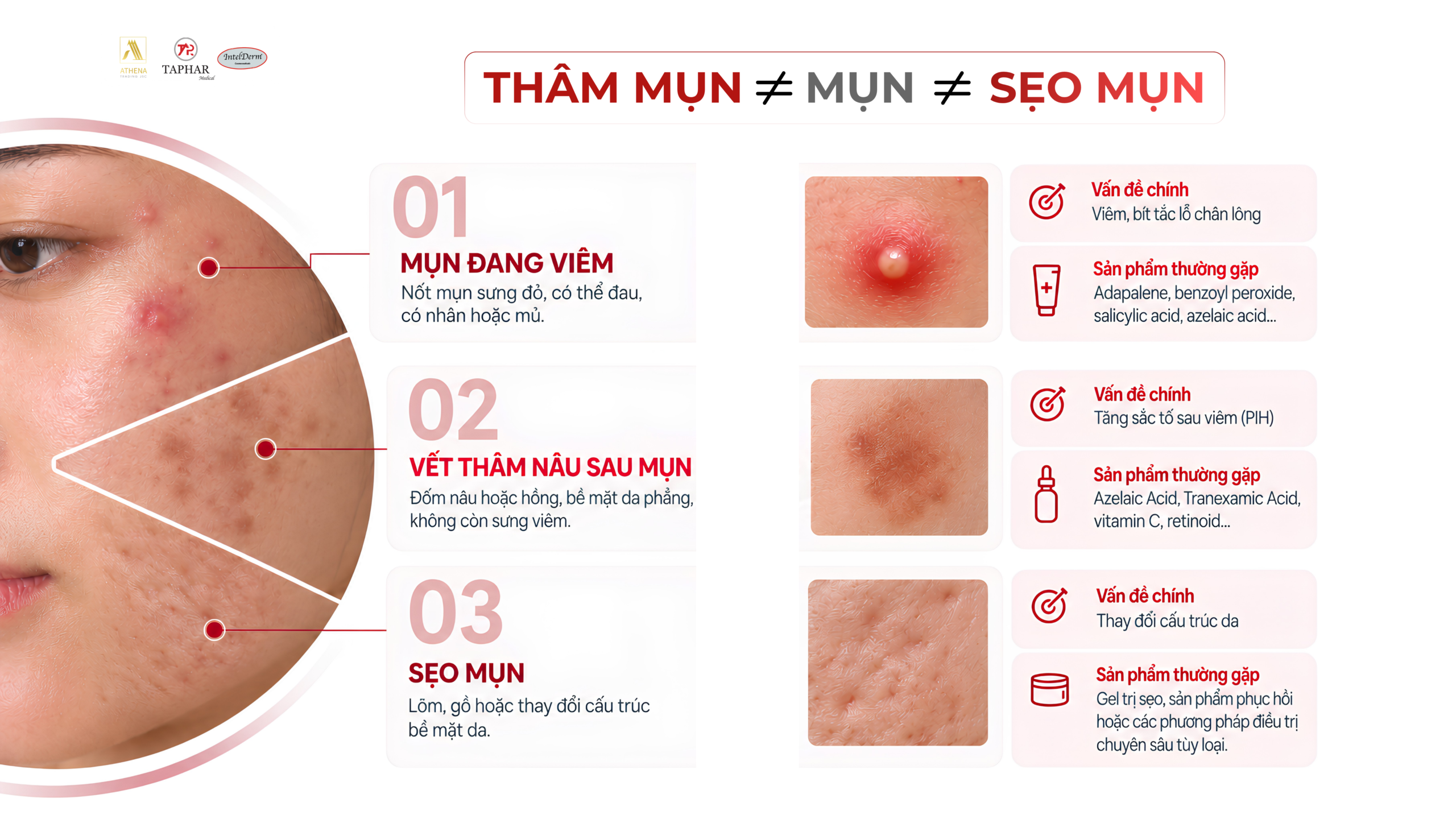 thuốc trị thâm mụn phân biệt vết thâm mụn và sẹo sau mụn