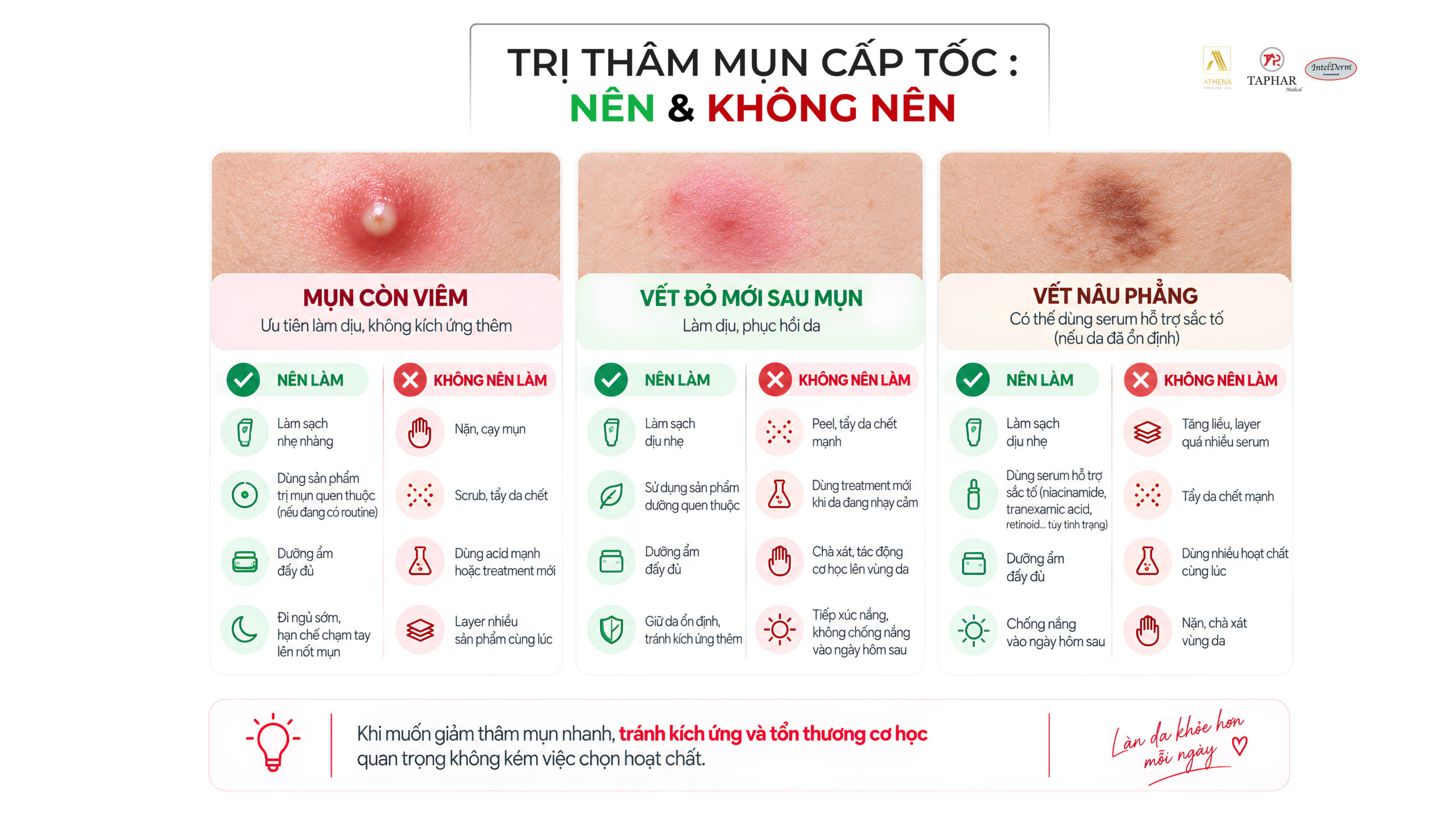 trị thâm mụn cấp tốc nên dùng gì và nên tránh gì