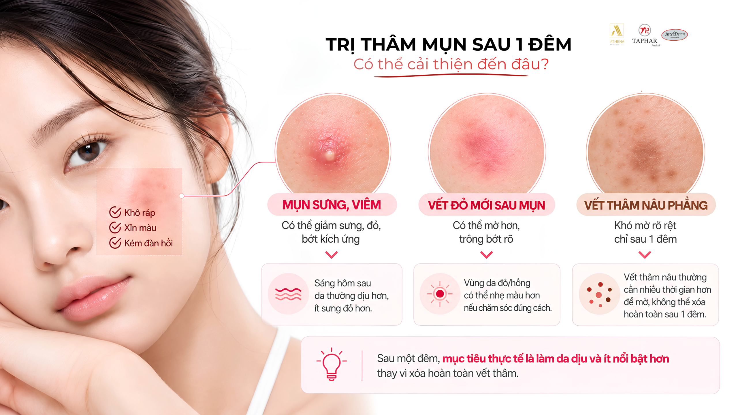 trị thâm mụn cấp tốc sau 1 đêm có thể cải thiện đến mức nào